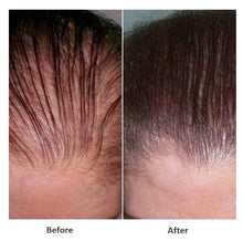 Lade das Bild in den Galerie-Viewer, MC EXOSOME HAIR – Regenerative Hair Treatment (5 x 1500IU)