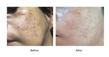 Load image into Gallery viewer, MC EXOSOME TRX – Intensive Brightening & Anti-Pigmentation Serum