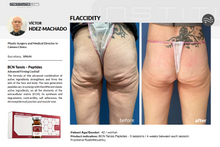 Load image into Gallery viewer, BCN Tensis-Peptides. 5x5ml