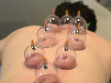 Load image into Gallery viewer, Kangzhu Manual Body Cupping Set (12 cups) # 524