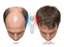Cargar imagen en el visor de la galería, Peine de crecimiento de microcorriente láser portátil para cabello # 983
