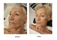 Load image into Gallery viewer, MC EXOSOME PDRN 5x1500 U.I. – Advanced Skin Regeneration
