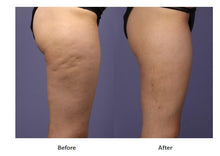 Cargar imagen en el visor de la galería, MC EXOSOME HYALURONIDASE – Enzymatic Detox &amp; Smoothing Solution
